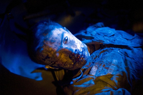 An Afghan soldier wounded by an IED