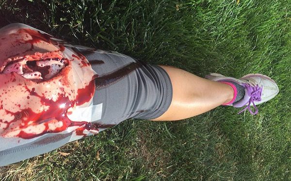 Jenny's 'wounded' leg from a disaster drill. 